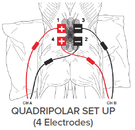 TENS EMS Combo Unit Portable Electrotherapy Muscle Stimulator by Quad Stim  Plus - 4 Different Channels - OTC Stim Tens Therapy Machine for Pain Relief